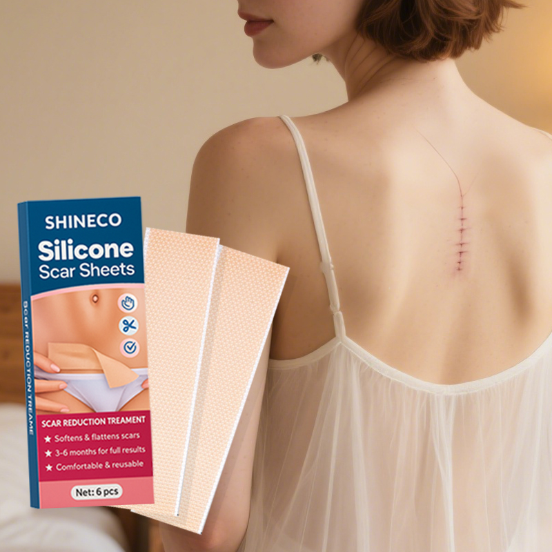 Silicone Scar Sheet